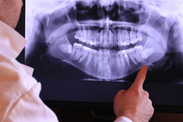 Best Emergency Tooth Extraction in North Richmond, CA