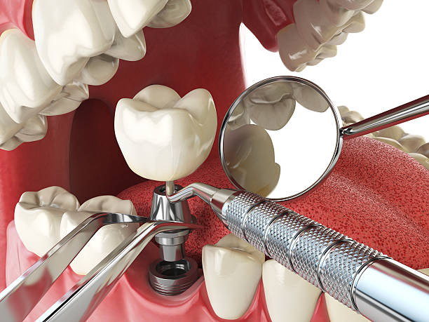 Best Emergency Broken Tooth Repair in North Richmond, CA