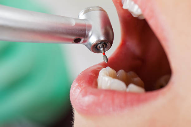 Best Pediatric Emergency Dentist in North Richmond, CA